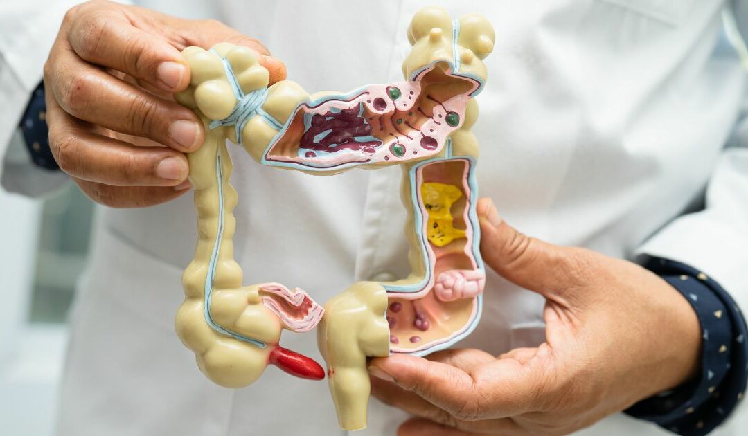 What is Gut Microbiome? The Basics of Gut Microbiome