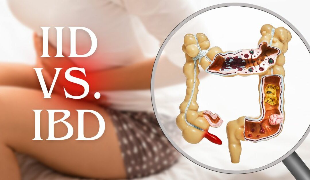 Intestinal Inflammatory Disease vs. Inflammatory Bowel Disease